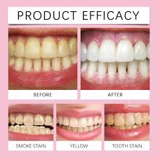 FORT Teeth Whitening Powder – 100% Natural Strong Formula for Cleaner, Whiter Teeth Natural Teeth Whitening Powder – Strong Dental Cleaning & Stain Removal Formula (50ml) FORT Dental Whitening Powder – Gentle & Effective Natural Teeth Brightening Solution